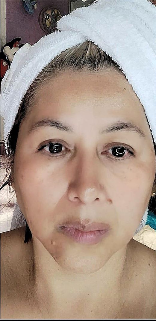 After Image Alt Text