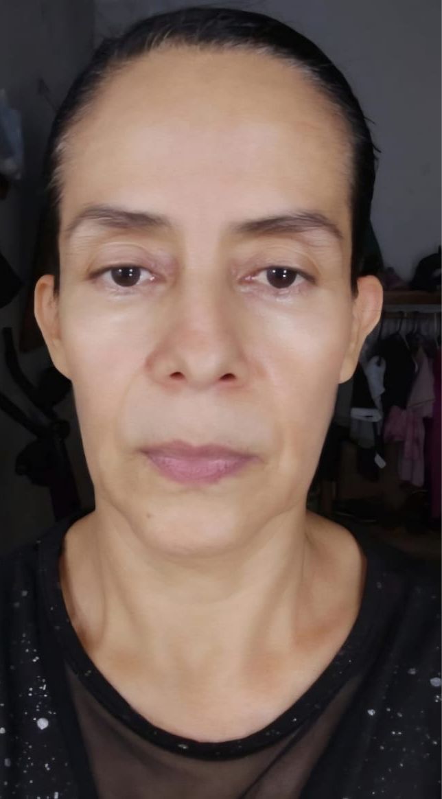 After Image Alt Text